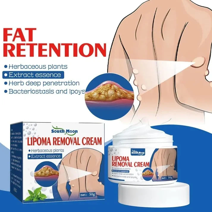 Lipoma Removal Cream